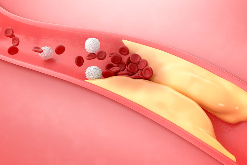 Yo, zaelana, ¿habré heredado la HF?