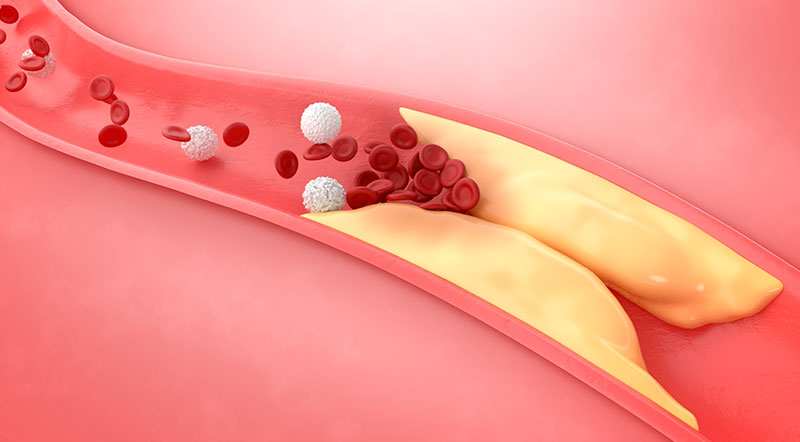 Yo, zaelana, ¿habré heredado la HF?