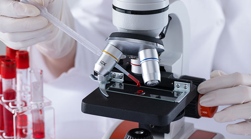 Mieloma mútiple, un gran desconocido